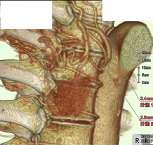図3　CT-Angiography
